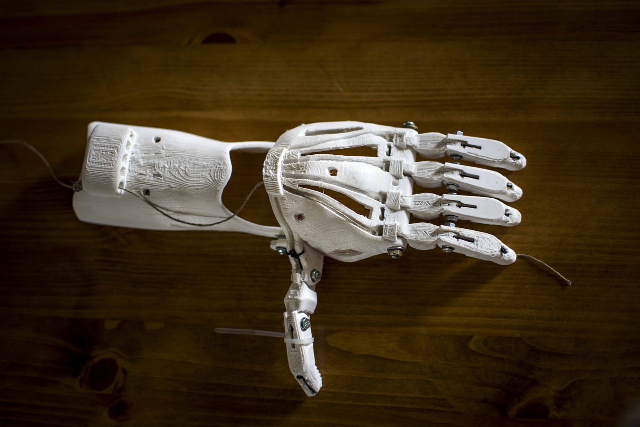 3d printed prosthetic arm